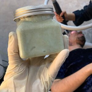 کربن تراپی و پیلینیگ هالیوودی مراقبت های قبل و بعد از آن |کلینیک لیان قم 1404 4 کربن تراپی ( پیلینگ هالیوودی )