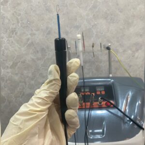 حذف ضایعه پوستی